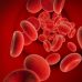 Anemia falciforme: entenda a condição