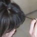Tricotilomania: conheça o distúrbio que faz as pessoas arrancarem os cabelos